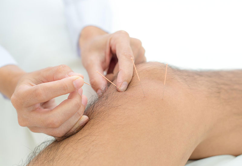 A close-up view of an acupuncture session targeting the knee, showing a patient sitting comfortably with their leg extended. Several fine needles are gently inserted around the knee area, while an acupuncturist attentively adjusts the placement of the needles. The background features a peaceful treatment room, enhancing the calming atmosphere of the session.