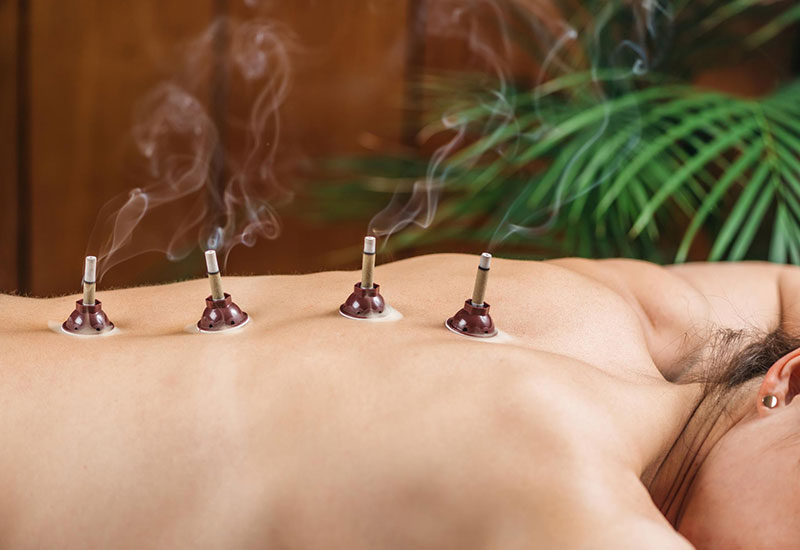 Close-up view of a moxibustion session showing a burning moxa stick held near a person's skin, emitting smoke.